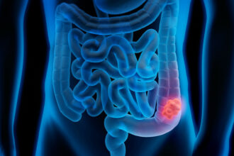 9gkowblrmcgtk8jqtf1yvz4f90jvlwjmm5xpoo4j-jpg