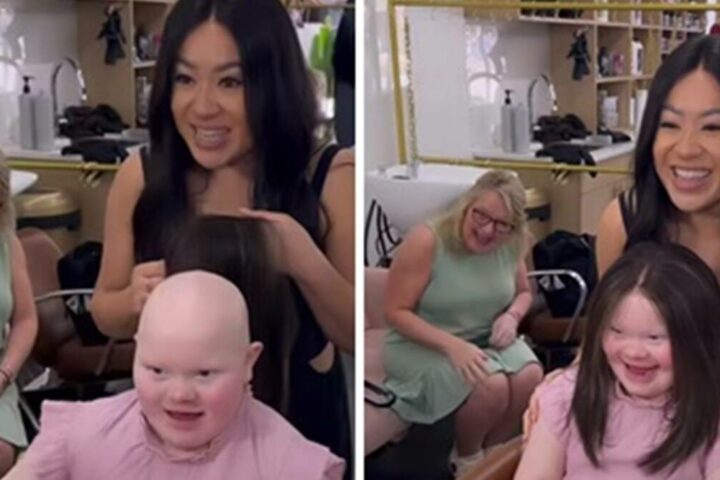 hair-fixing-for-alopecia-crop-jpg